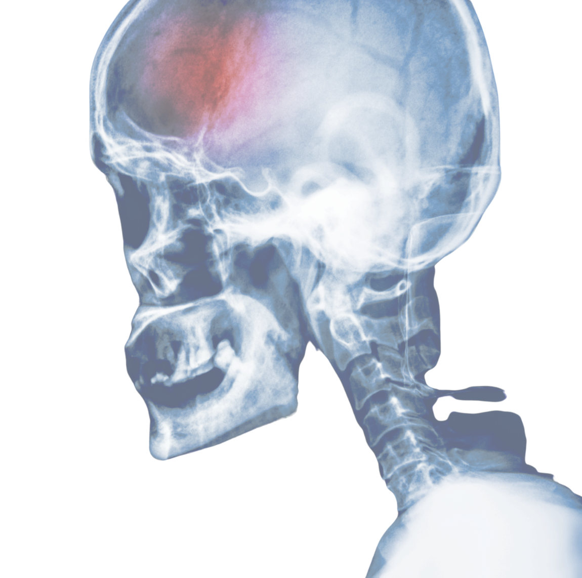 Brain scan